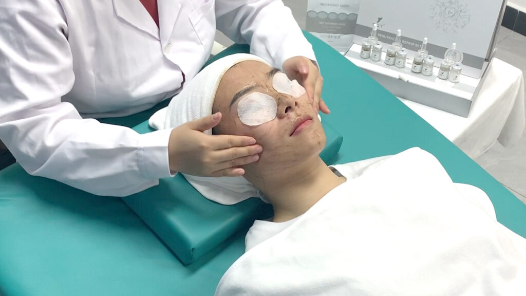 SQT® Bio-Microneedling mit 100 % natürlichen Mikro-Spicules regt Kollagen, Durchblutung & Regeneration an – ganz ohne Geräte oder Chemie.