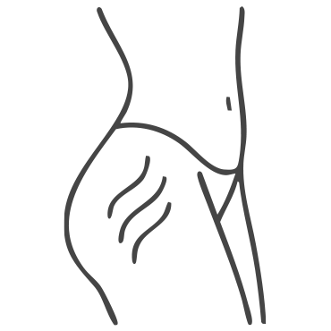 icon-miquency-dehnungsstreifen